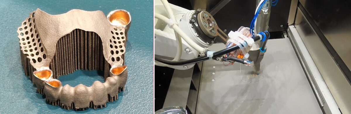 Vasemmalla metallinen hammasproteesi multimateriaalitulosteena. Oikealla multimateriaalitulostusprosessi, jossa käsivarsirobotti käy tulostamassa jauhepetiin.