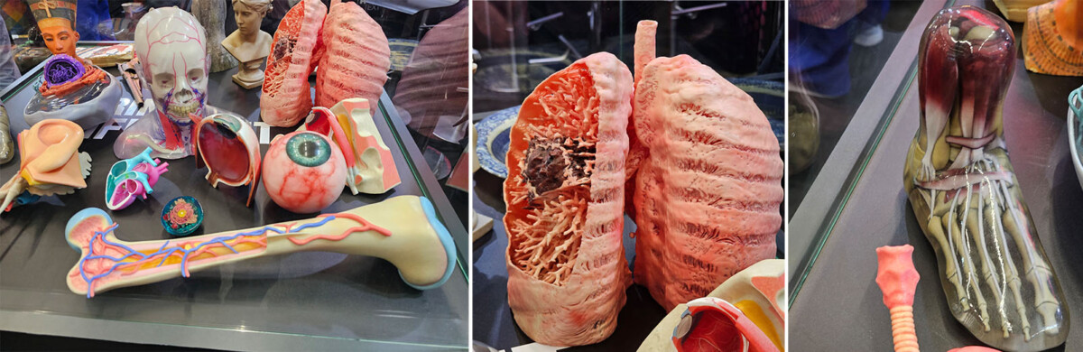 Kolmessa kuvassa on anatomisia malleja: ensimmäisessä on erilaisia elimiä, kuten aivot, silmä ja luu, toisessa yksityiskohtainen malli sairaista keuhkoista ja kolmannessa jalka ja nilkka, jossa on näkyvissä luita ja jänteitä.