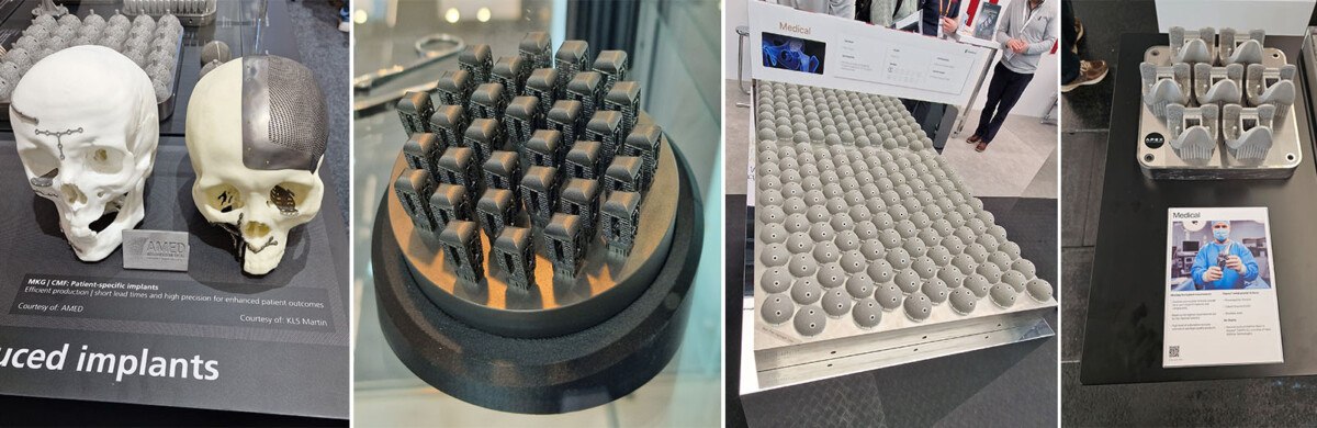Neljästä kuvasta koostuvassa kollaasissa näkyy 3D-tulostettuja kalloimplantteja, lähikuva metallisista 3D-tulostetuista ristikkorakenteista, harmaita pallomaisia esineitä sisältävä tarjotin ja metallisia teollisuusosia sisältävä näyttö, jossa on informaatiokyltti.